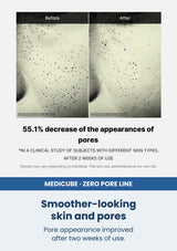 Medicube zero pore one day cream 50ml — Smoother-looking skin and pores. Pore appearance improved after two weeks of use.