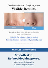 Medicube zero pore pad mild 155g 70 pads — Smooth skin. Refined-looking pores. Gentle exfoliation with a refreshing after-feel.