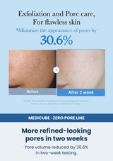 Medicube zero pore toner 250ml — More refined-looking pores in two weeks. Pore volume reduced by 30.6% in two-week testing.