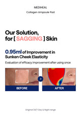MEDIHEAL Collagen Ampoule Pad original results information