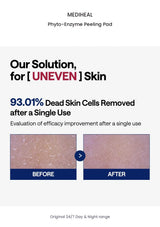 MEDIHEAL Phyto-Enzyme Peeling Pad original results information