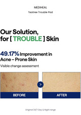 MEDIHEAL Teatree Trouble Pad original results information