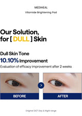 MEDIHEAL Vitamide Brightening Pad original results information