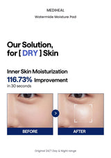 MEDIHEAL Watermide Moisture Pad original results information