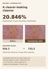Original MOLVANY blackhead cleansing comparison showing 20.846% improvement immediately after one use