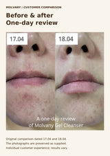 Original MOLVANY customer before-and-after review photos dated 17.04 and 18.04