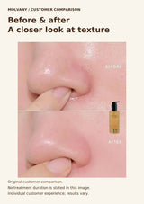 Original MOLVANY customer skin-texture before-and-after comparison