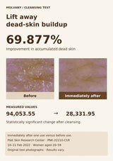 Original MOLVANY dead-skin comparison showing 69.877% improvement immediately after one use