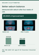 MOLVANY Toner Pad: Better sebum balance. 29.650% improvement after four weeks. Before-and-after study photographs.