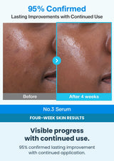 Numbuzin No.3 Visible pore improvements after four weeks
