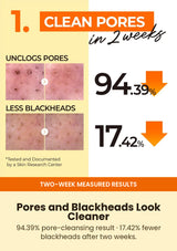 Numbuzin No.1 two-week pore and visible-blackhead cleansing results