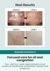 Numbuzin No.1 calming toner four-week oil and pore results