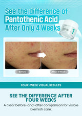Four-week visual comparison for Numbuzin No.1 soothing cream