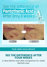 Four-week visual comparison for Numbuzin No.1 soothing serum
