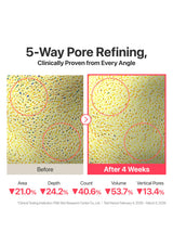 Before and after comparison of 5-way pore refining treatment with clinical data on a white background.