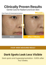 Numbuzin No.5+ serum dark-spot result after four weeks