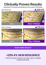NUMBUZIN No.9 four-week skin resilience and neck wrinkle results