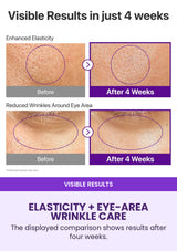 NUMBUZIN No.9 four-week elasticity and eye-area wrinkle results