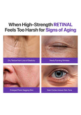Advertisement for skincare product showing signs of aging on skin with text about high-strength retinal.