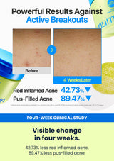 Numbuzin No.0 balancing dual pads four-week clinical result