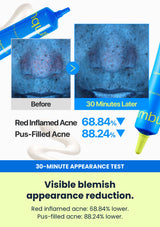 Numbuzin No.0 30-minute measured acne appearance result