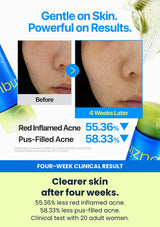 Numbuzin No.0 sulfur cleansing foam four-week clinical result