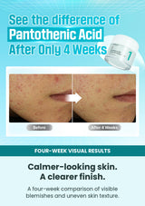 Four-week visual comparison for Numbuzin No.1 soothing cream