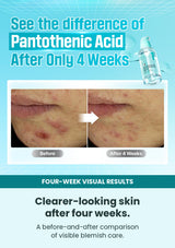 Four-week visual comparison for Numbuzin No.1 soothing serum