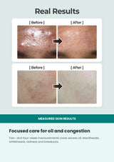 Numbuzin No.1 calming toner four-week oil and pore results