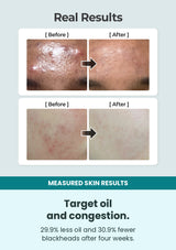 Numbuzin No.1 calming herb toner before-and-after oil and skin-clarity results