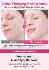 Numbuzin No.2 Rose PDRN serum before-and-after plumping results in four facial areas