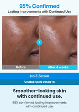 Numbuzin No.3 Blue Bio-Retinol Pore Refining Serum (1 Pack = 1.3ml x 10 Pieces) — visible skin results