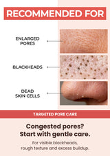 Skin concerns for Numbuzin No.4 toner pads: pores, blackheads and dead skin cells