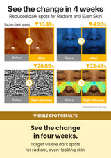 Numbuzin No.5 Glutathione Vitamin Dark Spot Cream 50ml — visible spot results: See the change in four weeks.