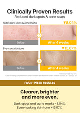 Numbuzin No.5+ Vitamin Niacinamide Concentrated Pad 180ml (1 Box = 70 Pads) — four-week results: Clearer, brighter and more even.