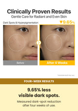 Numbuzin No.5+ Vitamin Concentrated Serum 30ml — four-week results: 9.65% less visible dark spots.