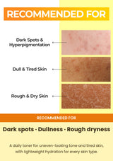 NUMBUZIN No.5+ toner recommended for dark spots dullness and rough dry skin