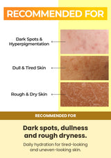 Numbuzin No.5+ Vitamin Boosting Essential Toner 200ml — recommended for: Dark spots, dullness and rough dryness.