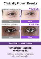 NUMBUZIN No.9 eye patches — Smoother-looking under-eyes. Puffiness and wrinkle comparisons after patch application.