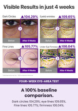 NUMBUZIN No.9 eye10 — A 100% baseline comparison. Dark circles 104.29%; eye lines 109.65%. Fine lines 105.77%; firmness 106.04%.