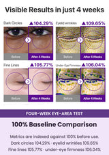 Numbuzin No.9 four-week dark-circle, wrinkle, fine-line and firmness comparison