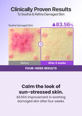 NUMBUZIN No.9 NAD+ Peptides Dewy Sun Essence — Calm the look of sun-stressed skin. 83.56% improvement in soothing damaged skin after four weeks.