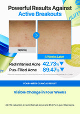 Numbuzin No.0 balancing dual pads four-week clinical result