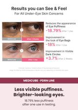 MEDICUBE PDRN Pink Caffeine Collagen Eye Patch puffiness and dark circle test results