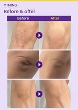 YTNING Scaling Toning Scrub Wash three before-and-after body-skin photograph pairs