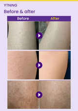 YTNING Scaling Toning Scrub Wash three before-and-after body-skin photograph pairs