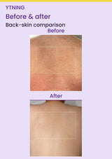 YTNING Scaling Toning Scrub Wash before-and-after back-skin photographs