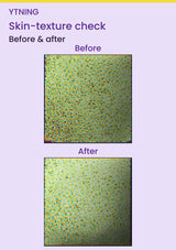 YTNING Scaling Toning Scrub Wash before-and-after skin-texture measurement images