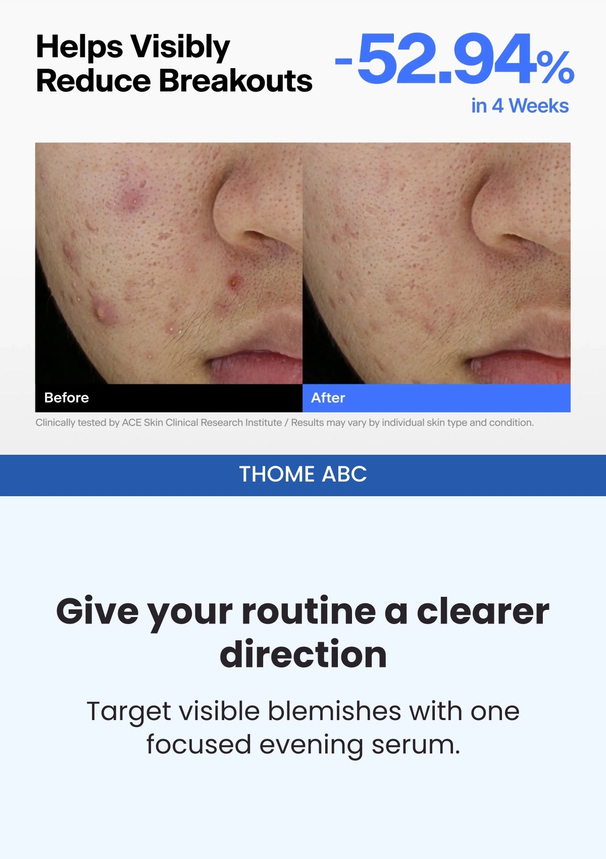 THOME ABC — Breakouts after four weeks