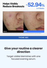 THOME ABC — Breakouts after four weeks